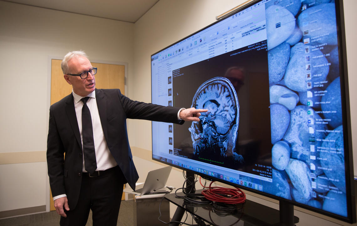 Bruce Pike, professor of radiology and clinical neurosciences, says, “The idea of neurosurgery in an awake patient without breaking the skin is revolutionary."
